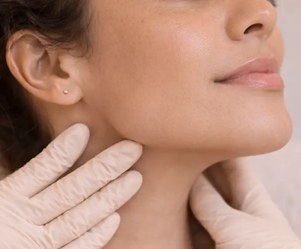 Nefertiti lift consultation Bournemouth jawline and neck tightening treatment