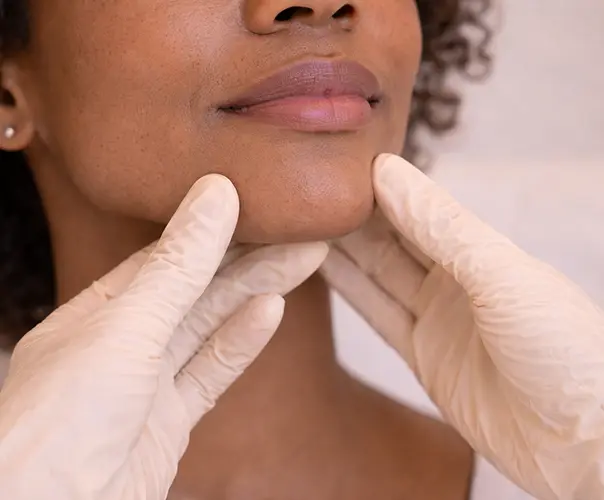 Pebble chin consultation Bournemouth chin dimpling treatment