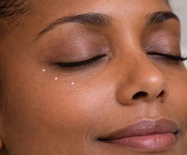 Polynucleotides eye treatment Bournemouth reducing dark circles and fine lines